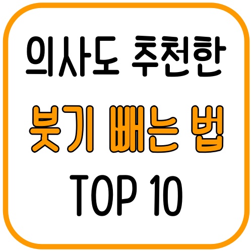 의사도 추천한 붓기 빼는법 TOP 10 2 의사도 추천한 붓기 빼는법 TOP 10