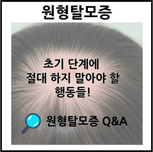 원형탈모증 초기 절대 하지 말아야 할 행동6가지 | 치료법 총정리 2 원형탈모증 초기 절대 하지 말아야 할 행동들 치료법 총정리